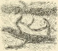 Picture 14 of 135 from A manual of modern surgery, general and operative : With 188 illus. in the text and 13 full-page plates in colors and tints, aggregating 276 separate figures. (1894), leaf 47