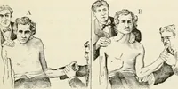 An illustration from A manual of modern surgery, general and operative : With 188 illus. in the text and 13 full-page plates in colors and tints, aggregating 276 separate figures. (1894)
