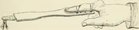 An illustration from A manual of modern surgery, general and operative : With 188 illus. in the text and 13 full-page plates in colors and tints, aggregating 276 separate figures. (1894)