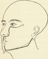 An illustration from A manual of modern surgery, general and operative : With 188 illus. in the text and 13 full-page plates in colors and tints, aggregating 276 separate figures. (1894)