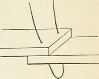 An illustration from A manual of modern surgery, general and operative : With 188 illus. in the text and 13 full-page plates in colors and tints, aggregating 276 separate figures. (1894)