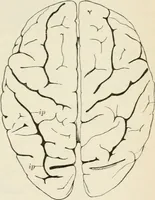 An illustration from A manual of modern surgery, general and operative : With 188 illus. in the text and 13 full-page plates in colors and tints, aggregating 276 separate figures. (1894)