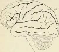An illustration from A manual of modern surgery, general and operative : With 188 illus. in the text and 13 full-page plates in colors and tints, aggregating 276 separate figures. (1894)