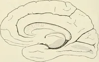 An illustration from A manual of modern surgery, general and operative : With 188 illus. in the text and 13 full-page plates in colors and tints, aggregating 276 separate figures. (1894)