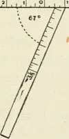 An illustration from A manual of modern surgery, general and operative : With 188 illus. in the text and 13 full-page plates in colors and tints, aggregating 276 separate figures. (1894)