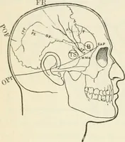 An illustration from A manual of modern surgery, general and operative : With 188 illus. in the text and 13 full-page plates in colors and tints, aggregating 276 separate figures. (1894)