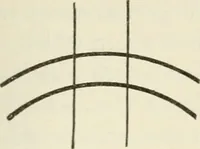 An illustration from A manual of modern surgery, general and operative : With 188 illus. in the text and 13 full-page plates in colors and tints, aggregating 276 separate figures. (1894)