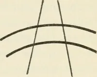 An illustration from A manual of modern surgery, general and operative : With 188 illus. in the text and 13 full-page plates in colors and tints, aggregating 276 separate figures. (1894)
