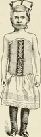 Picture 99 of 135 from A manual of modern surgery, general and operative : With 188 illus. in the text and 13 full-page plates in colors and tints, aggregating 276 separate figures. (1894), leaf 603