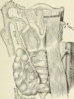 An illustration from A manual of modern surgery, general and operative : With 188 illus. in the text and 13 full-page plates in colors and tints, aggregating 276 separate figures. (1894)
