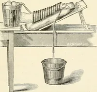 Picture 20 of 135 from A manual of modern surgery, general and operative : With 188 illus. in the text and 13 full-page plates in colors and tints, aggregating 276 separate figures. (1894), leaf 65