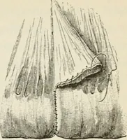 An illustration from A manual of modern surgery, general and operative : With 188 illus. in the text and 13 full-page plates in colors and tints, aggregating 276 separate figures. (1894)