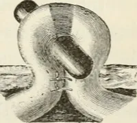 An illustration from A manual of modern surgery, general and operative : With 188 illus. in the text and 13 full-page plates in colors and tints, aggregating 276 separate figures. (1894)