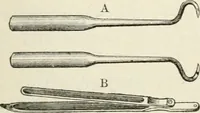 An illustration from A manual of modern surgery, general and operative : With 188 illus. in the text and 13 full-page plates in colors and tints, aggregating 276 separate figures. (1894)