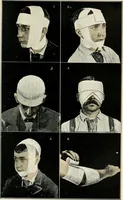 Picture 123 of 135 from A manual of modern surgery, general and operative : With 188 illus. in the text and 13 full-page plates in colors and tints, aggregating 276 separate figures. (1894), leaf 715