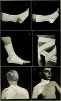 An illustration from A manual of modern surgery, general and operative : With 188 illus. in the text and 13 full-page plates in colors and tints, aggregating 276 separate figures. (1894)