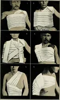 An illustration from A manual of modern surgery, general and operative : With 188 illus. in the text and 13 full-page plates in colors and tints, aggregating 276 separate figures. (1894)