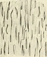 An illustration from A manual of modern surgery, general and operative : With 188 illus. in the text and 13 full-page plates in colors and tints, aggregating 276 separate figures. (1894)