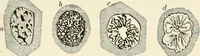 An illustration from A manual of modern surgery, general and operative : With 188 illus. in the text and 13 full-page plates in colors and tints, aggregating 276 separate figures. (1894)