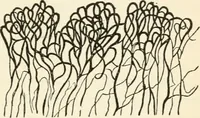 An illustration from A manual of modern surgery, general and operative : With 188 illus. in the text and 13 full-page plates in colors and tints, aggregating 276 separate figures. (1894)