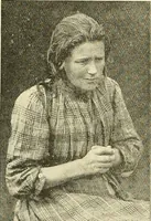 An illustration from Mental diseases : A text-book of psychiatry for medical students and practitioners / by R.H. Cole, ... With fifty-two illustrations and plates. (1913)