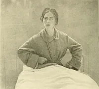 An illustration from Mental diseases : A text-book of psychiatry for medical students and practitioners / by R.H. Cole, ... With fifty-two illustrations and plates. (1913)