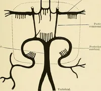An illustration from Mental diseases : A text-book of psychiatry for medical students and practitioners / by R.H. Cole, ... With fifty-two illustrations and plates. (1913)