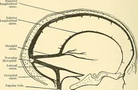 An illustration from Mental diseases : A text-book of psychiatry for medical students and practitioners / by R.H. Cole, ... With fifty-two illustrations and plates. (1913)