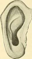 An illustration from Mental diseases : A text-book of psychiatry for medical students and practitioners / by R.H. Cole, ... With fifty-two illustrations and plates. (1913)