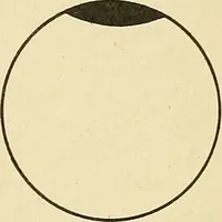 An illustration from Mental diseases : A text-book of psychiatry for medical students and practitioners / by R.H. Cole, ... With fifty-two illustrations and plates. (1913)