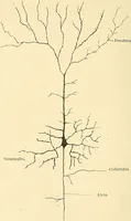 An illustration from Mental diseases : A text-book of psychiatry for medical students and practitioners / by R.H. Cole, ... With fifty-two illustrations and plates. (1913)