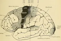 An illustration from Mental diseases : A text-book of psychiatry for medical students and practitioners / by R.H. Cole, ... With fifty-two illustrations and plates. (1913)