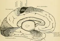 An illustration from Mental diseases : A text-book of psychiatry for medical students and practitioners / by R.H. Cole, ... With fifty-two illustrations and plates. (1913)