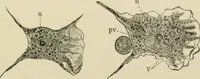 An illustration from Diseases of metabolism and of the blood : animal parasites, toxicology / ed. by Richard C. Cabot ... An authorized translation from "Die deutsche klinik" under the general editorial supervision of Julius L. Salinger, M. D. With one colored plate and fifty-eight illustrations in the text. (1906)