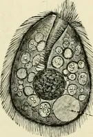 An illustration from Diseases of metabolism and of the blood : animal parasites, toxicology / ed. by Richard C. Cabot ... An authorized translation from "Die deutsche klinik" under the general editorial supervision of Julius L. Salinger, M. D. With one colored plate and fifty-eight illustrations in the text. (1906)