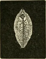 An illustration from Diseases of metabolism and of the blood : animal parasites, toxicology / ed. by Richard C. Cabot ... An authorized translation from "Die deutsche klinik" under the general editorial supervision of Julius L. Salinger, M. D. With one colored plate and fifty-eight illustrations in the text. (1906)
