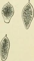 An illustration from Diseases of metabolism and of the blood : animal parasites, toxicology / ed. by Richard C. Cabot ... An authorized translation from "Die deutsche klinik" under the general editorial supervision of Julius L. Salinger, M. D. With one colored plate and fifty-eight illustrations in the text. (1906)