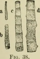 An illustration from Diseases of metabolism and of the blood : animal parasites, toxicology / ed. by Richard C. Cabot ... An authorized translation from "Die deutsche klinik" under the general editorial supervision of Julius L. Salinger, M. D. With one colored plate and fifty-eight illustrations in the text. (1906)