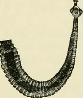 An illustration from Diseases of metabolism and of the blood : animal parasites, toxicology / ed. by Richard C. Cabot ... An authorized translation from "Die deutsche klinik" under the general editorial supervision of Julius L. Salinger, M. D. With one colored plate and fifty-eight illustrations in the text. (1906)