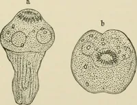 An illustration from Diseases of metabolism and of the blood : animal parasites, toxicology / ed. by Richard C. Cabot ... An authorized translation from "Die deutsche klinik" under the general editorial supervision of Julius L. Salinger, M. D. With one colored plate and fifty-eight illustrations in the text. (1906)