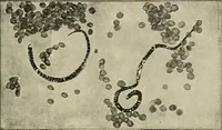 An illustration from Diseases of metabolism and of the blood : animal parasites, toxicology / ed. by Richard C. Cabot ... An authorized translation from "Die deutsche klinik" under the general editorial supervision of Julius L. Salinger, M. D. With one colored plate and fifty-eight illustrations in the text. (1906)