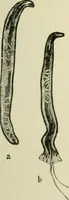 An illustration from Diseases of metabolism and of the blood : animal parasites, toxicology / ed. by Richard C. Cabot ... An authorized translation from "Die deutsche klinik" under the general editorial supervision of Julius L. Salinger, M. D. With one colored plate and fifty-eight illustrations in the text. (1906)
