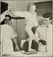 An illustration from Bismuth paste in chronic suppurations : its diagnostic importance and therapeutic value / by Emil G. Beck ... with an introduction by Carl Beck, M. D., and a chapter on the application of bismuth paste in the treatment of chronic suppuration of the nasal accessory sinuses and the ear, by Joseph C. Beck, M. D. With eighty-one engravings, nine diagrammatic illustrations, and a colored plate. (1914)