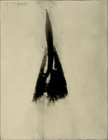 An illustration from Bismuth paste in chronic suppurations : its diagnostic importance and therapeutic value / by Emil G. Beck ... with an introduction by Carl Beck, M. D., and a chapter on the application of bismuth paste in the treatment of chronic suppuration of the nasal accessory sinuses and the ear, by Joseph C. Beck, M. D. With eighty-one engravings, nine diagrammatic illustrations, and a colored plate. (1914)