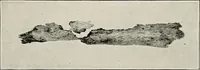 An illustration from Bismuth paste in chronic suppurations : its diagnostic importance and therapeutic value / by Emil G. Beck ... with an introduction by Carl Beck, M. D., and a chapter on the application of bismuth paste in the treatment of chronic suppuration of the nasal accessory sinuses and the ear, by Joseph C. Beck, M. D. With eighty-one engravings, nine diagrammatic illustrations, and a colored plate. (1914)