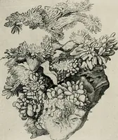 An illustration from Bismuth paste in chronic suppurations : its diagnostic importance and therapeutic value / by Emil G. Beck ... with an introduction by Carl Beck, M. D., and a chapter on the application of bismuth paste in the treatment of chronic suppuration of the nasal accessory sinuses and the ear, by Joseph C. Beck, M. D. With eighty-one engravings, nine diagrammatic illustrations, and a colored plate. (1914)