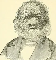 An illustration from An American text-book of genito-urinary diseases, syphilis and diseases of the skin / Ed. by L. Bolton Bangs ... and W. A. Hardaway ... Illustrated with 300 engravings and 20 full-page colored plates. (1898)