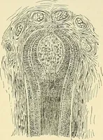 An illustration from An American text-book of genito-urinary diseases, syphilis and diseases of the skin / Ed. by L. Bolton Bangs ... and W. A. Hardaway ... Illustrated with 300 engravings and 20 full-page colored plates. (1898)