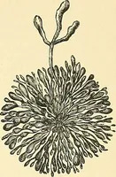 An illustration from An American text-book of genito-urinary diseases, syphilis and diseases of the skin / Ed. by L. Bolton Bangs ... and W. A. Hardaway ... Illustrated with 300 engravings and 20 full-page colored plates. (1898)