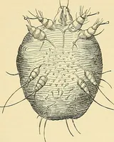 An illustration from An American text-book of genito-urinary diseases, syphilis and diseases of the skin / Ed. by L. Bolton Bangs ... and W. A. Hardaway ... Illustrated with 300 engravings and 20 full-page colored plates. (1898)